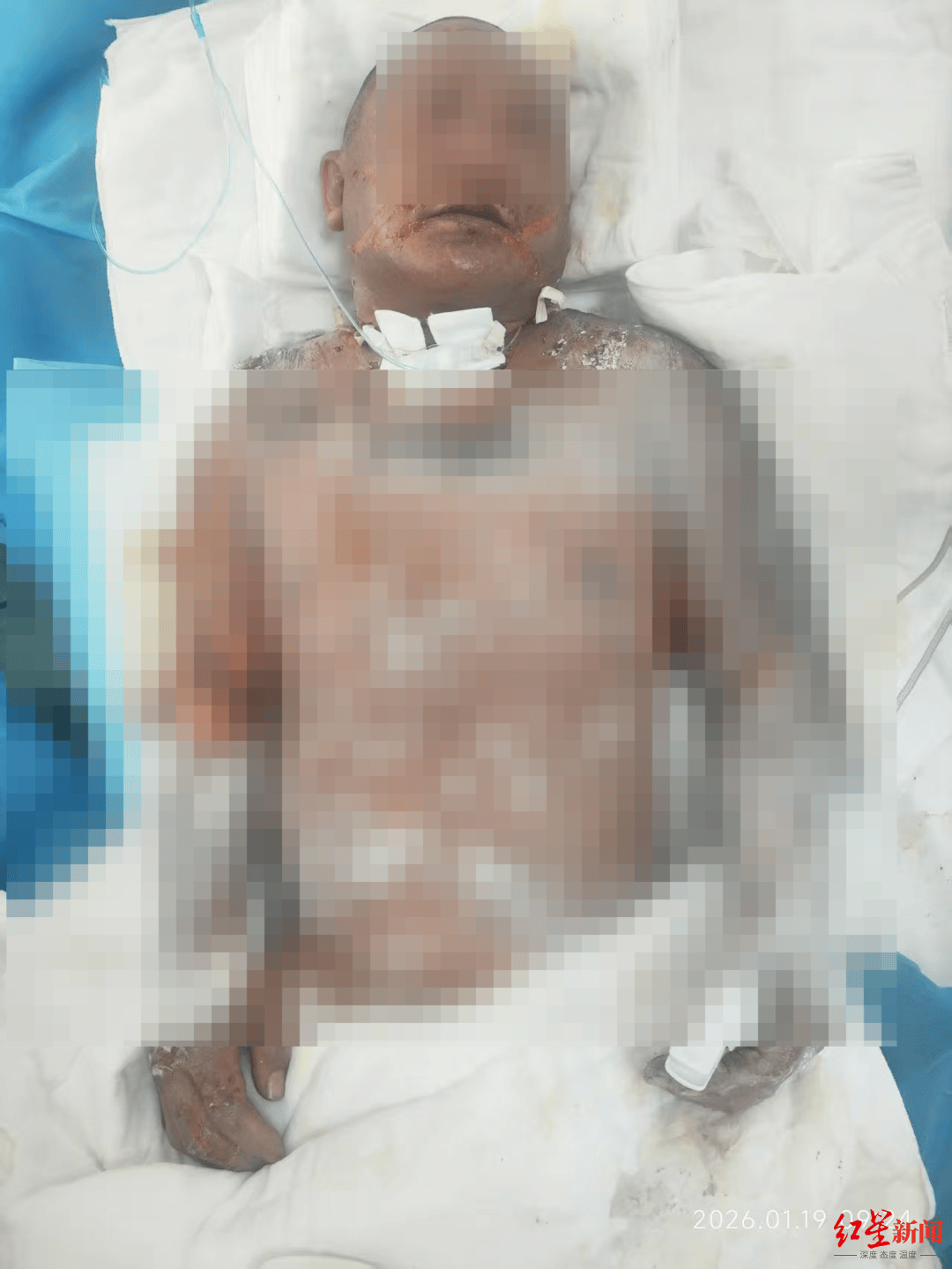 信用网皇冠申请注册_灌装燃气次日爆炸 丹东一对夫妻重度烧伤 新房成危房 家属：二人还在抢救