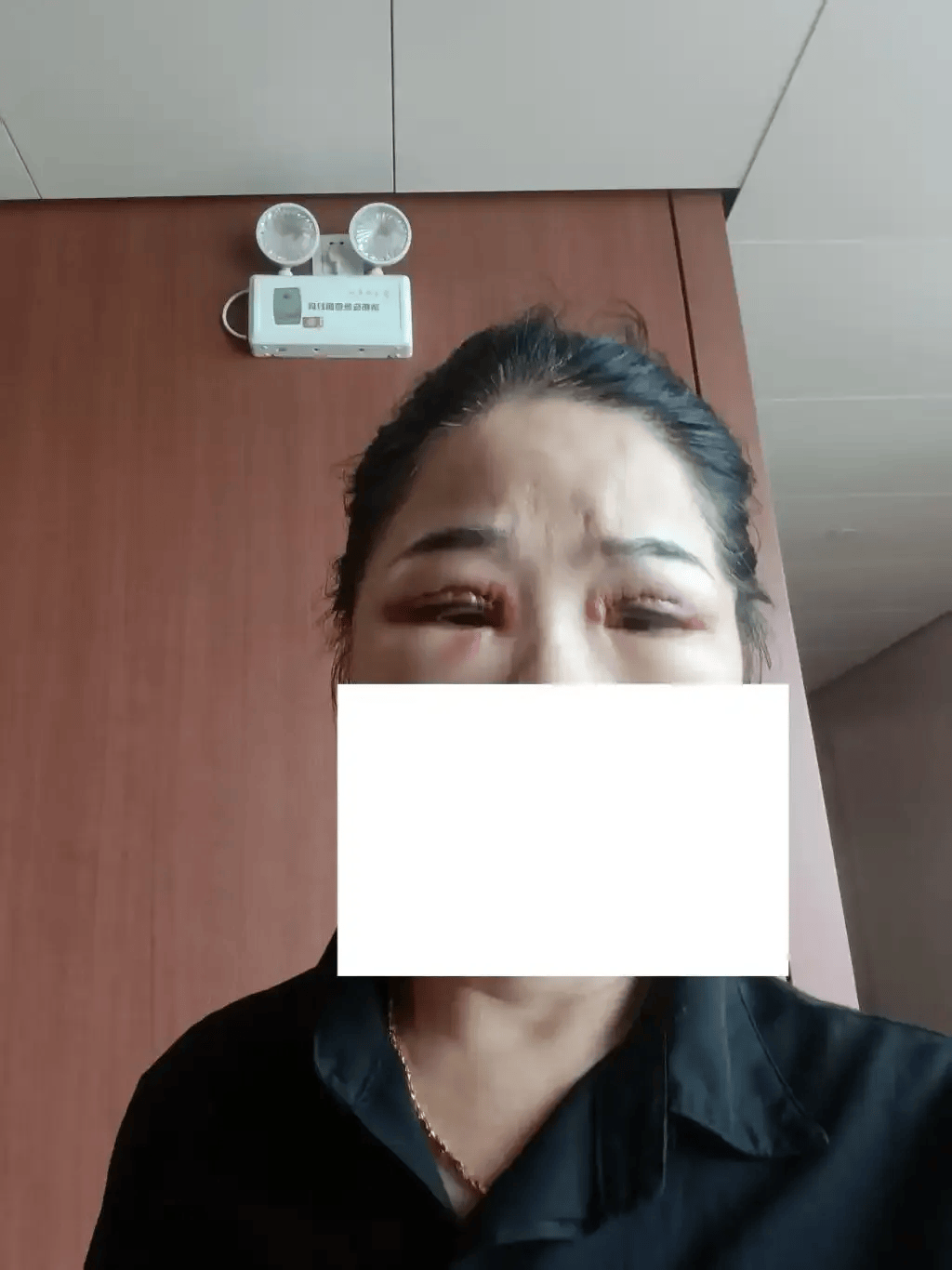 世界杯皇冠信用网代理_从600多元变成5万元世界杯皇冠信用网代理，广东57岁保洁员掏空积蓄做医美，双眼皮手术后眼睛红痛、视物模糊，当事人：销售像人贩子一样围着我；机构拒绝回应