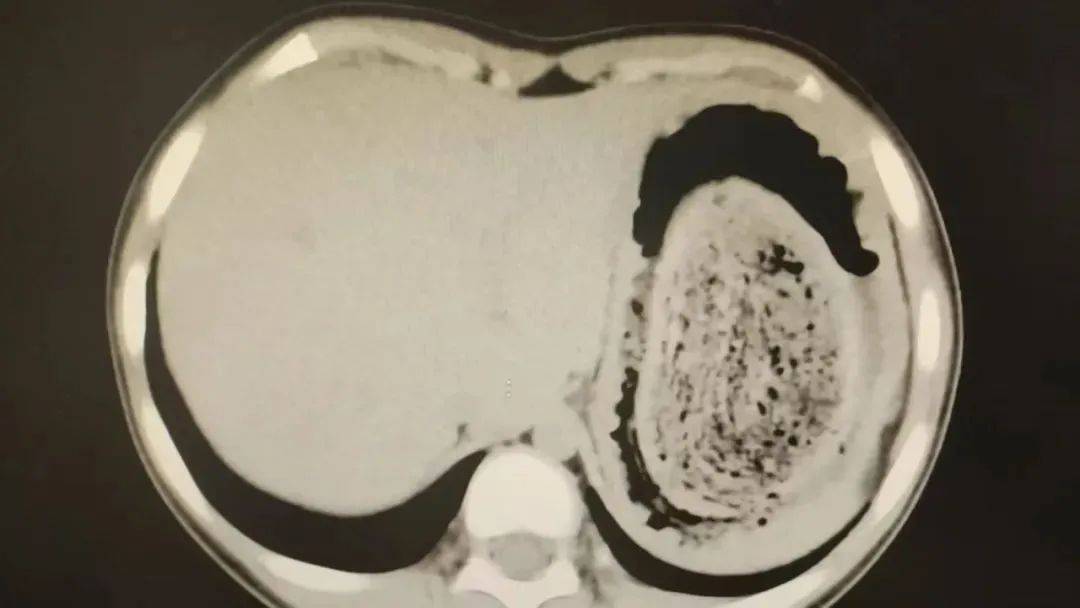 皇冠信用網在线注册_发现一例皇冠信用網在线注册，10岁女孩确诊！已有多起病例，有人因羞耻感延误就医