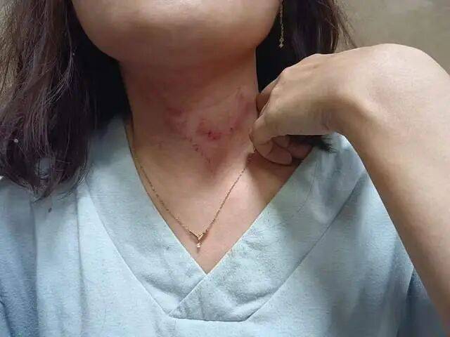 皇冠信用网正网_一男子凌晨听到两声呼救皇冠信用网正网，循声发现一女子在奔驰车外被白衣男勒昏！受害者：是受朋友之托借钱给白衣男，凌晨被骗至偏僻处遭非礼！